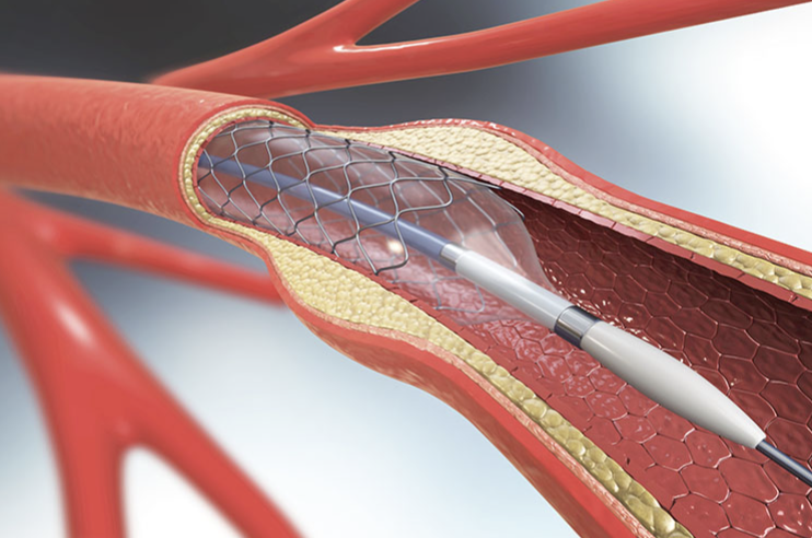 artikel dan berita terbaru bethsaida hospital