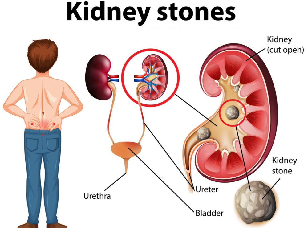 artikel dan berita terbaru bethsaida hospital