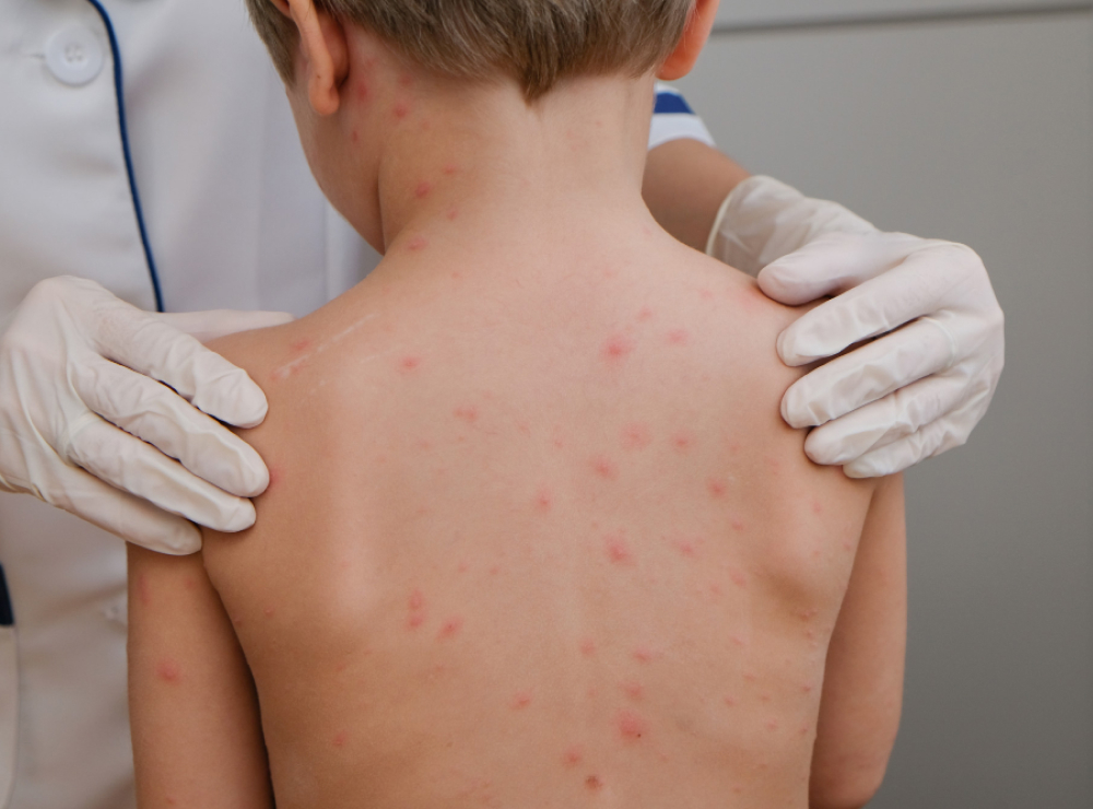 artikel dan berita terbaru bethsaida hospital