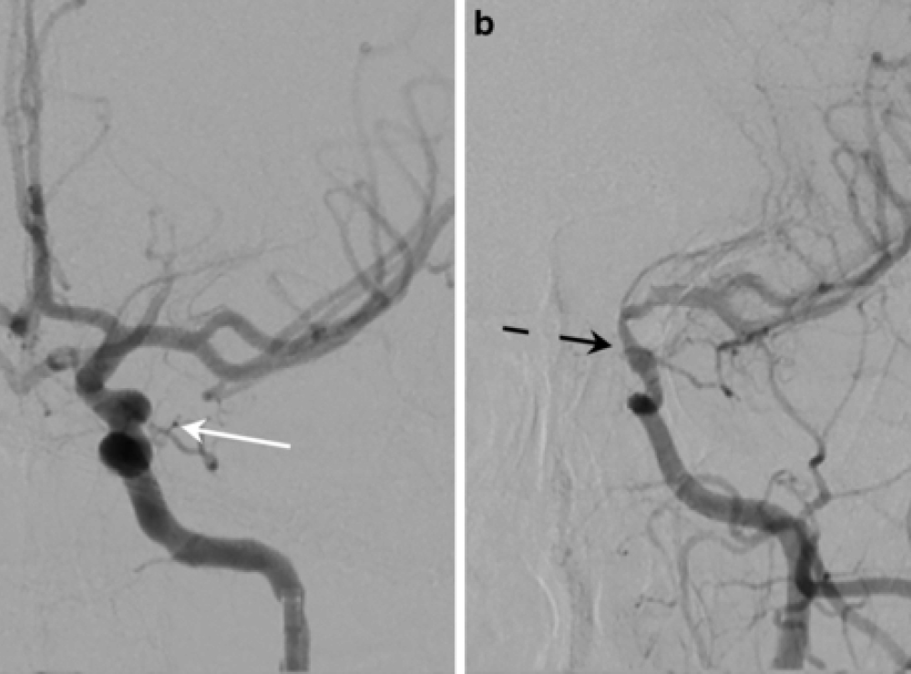 artikel dan berita terbaru bethsaida hospital