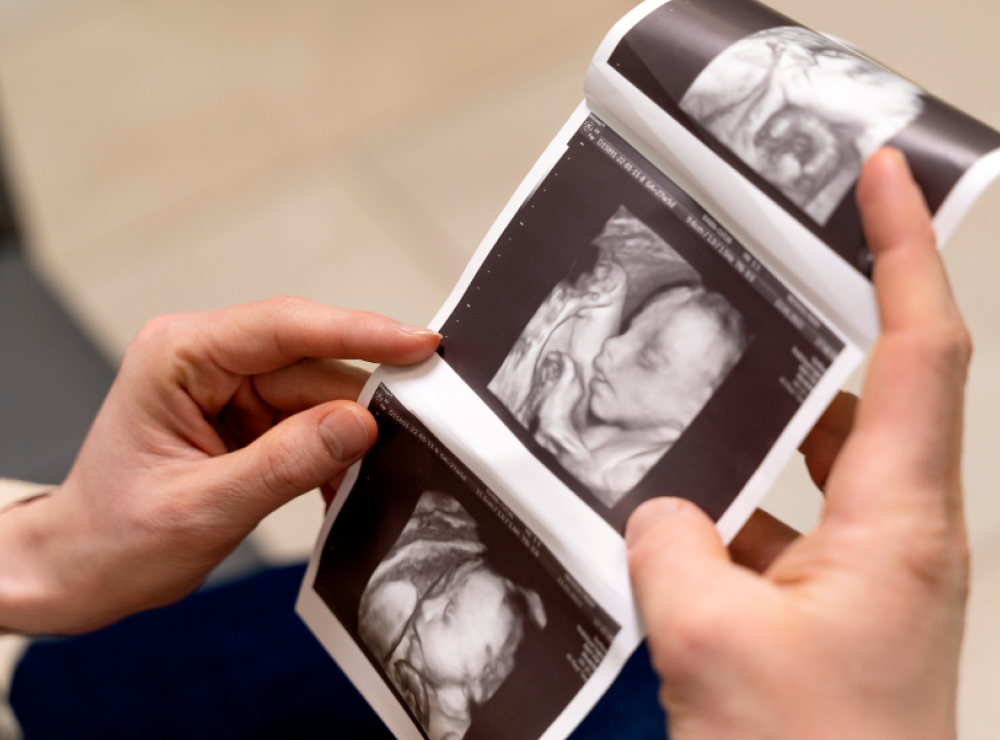 artikel dan berita terbaru bethsaida hospital