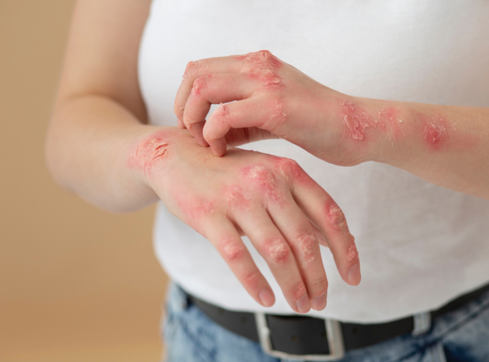 artikel dan berita terbaru bethsaida hospital